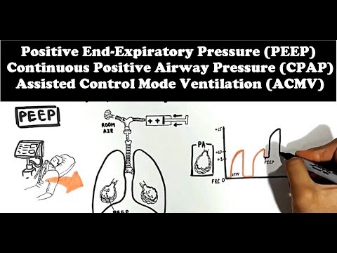 Mechanical Ventilator (Lung Mechanics: PEEP, CPAP, ACMV)