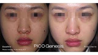 Enlighten (PICO Genesis): No More Makeup