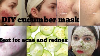 BEST DIY _100 SKIN  PROBLEMS and ONE solution_Best CUCUMBER Mask for skin treatment