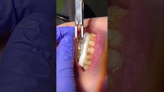Why Are His Teeth So BROWN?! 😮🦷