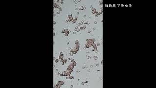 顯微鏡下的世界～血液🩸紅血球