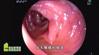 51164_大腸癌：我應該做哪些篩檢檢查？(國語版)