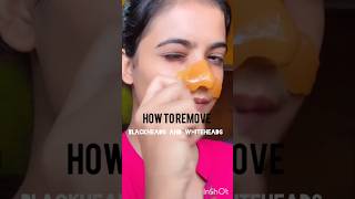 How to remove blackheads and whiteheads at home🤩#ytshorts#shortsfeed #video #skincare#youtubeshorts