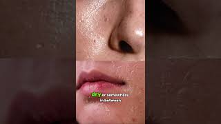 the skincare solution for TEENS! 😮‍💨✨ we ate with this formula fr #teenskincare #teen #skincare