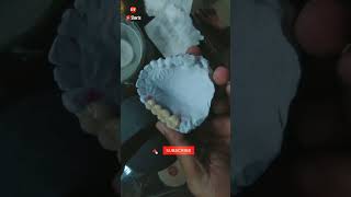 metal ceramic| laboratory| pfm| ceramic finishing| #dentaltech #shorts #youtubeshorts #short #lab