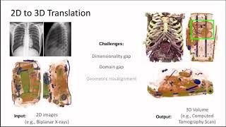 ICCV 2023 - Unaligned 2D to 3D Translation with Conditional VQ Code Diffusion using Transformers
