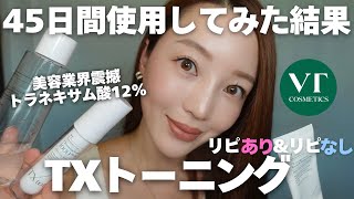 【色素沈着＆くすみ改善】話題のTXトーニングシリーズ忖度なし45日間検証！