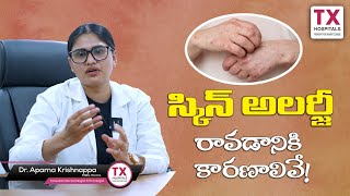 Skin Allergies: Causes, Precautions & Solutions with Dr. Aparna Krishnappa || TX Hospitals