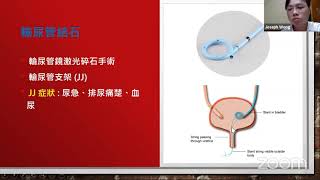 泌尿外科手術常見之併發症｜HKSE 2021年3月直播講座