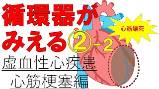 【心筋梗塞】虚血性心疾患②　心筋梗塞のメカニズムと治療薬　医療系学生必見！