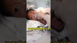 孩子的世界是最纯真的❤️新生儿科 早产儿 工作日常 儿科医生 勇敢的宝宝