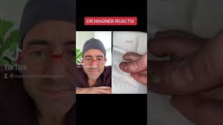 DRAINAGE OF PUS-FILLED PIMPLE😬#shorts #pimple #comedy #cyst