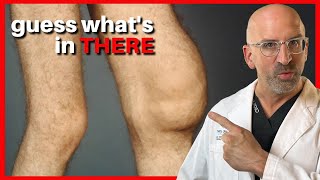 SWOLLEN Joint - What's in there? 💦 #shorts