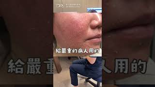 看幾家皮膚科都好不了！問題出在這！ #皮膚科 #皮膚問題 #痘疤 #痘痘 #斑點 #毛孔粗大 #膚質改善