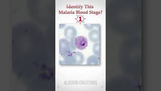 Can you guess this Malaria Blood stage ? 😎🤓 #quiz 40