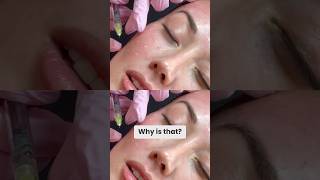 Redensity 1 Injections! 😱 #skincare #antiaging