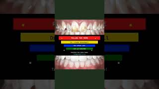 Dentist: The SHOCKING Reason Your Child's Teeth Hurt AFTER Whitening