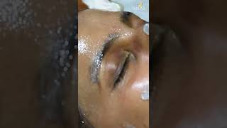 Obagi peel #obagi #shorts #ytshorts