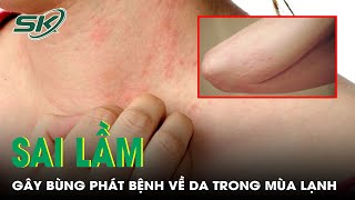 Những Sai Lầm Gây Bùng Phát Bệnh Về Da Trong Mùa Lạnh | SKĐS