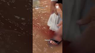 Flooding Shatters Basement Window Into Man's Leg During Cleanup