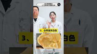 这三种阴道炎，上个厕所就可能看出来#医学科普 #健康科普 #涨知识 #关爱女性健康