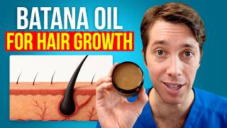 Batana Oil for Hair Growth | Hair Surgeon Reacts