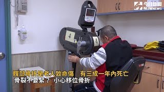 髖部骨折是老人致命傷　有三成一年內死亡