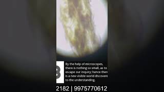Mosquito Larva Under Microscope #microscope #scienceexperiment #biology #shorts #malegaon