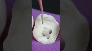 Satisfying Root Canal and Crown Process #shorts