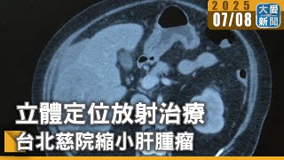 立體定位放射治療 台北慈院縮小肝腫瘤｜大愛新聞 @DaaiWorldNews
