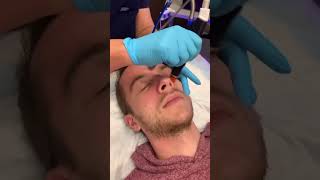 #aesthetician #beautytreatment #skincare #skincaretreatment #aesthetic #beauty #hydrafacial #botox