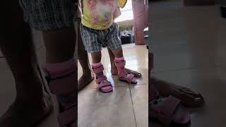 AFO UNTUK KAKI JINJIT !!! (SEPATU ORTOPEDI)