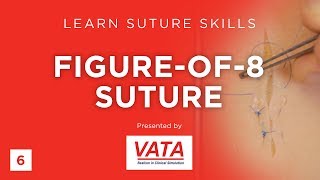 Figure-of-8 Suture - Learn Suture Techniques - VATA