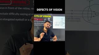 Defects of Vision #physics #science #education #neet #gseb10th