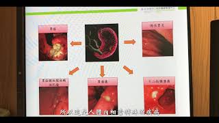 常喝茶喝咖啡，容易有胃部疾病？醫師破解謠言：兇手是「它」！