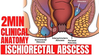 ischiorectal abscess clinical anatomy of ischiorectal fossa | ischioanal fossa clinical anatomy