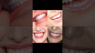 Whiter Teeth & Fresh Breath? Do These 4 Easy Steps Daily! #shorts #teethcare #oralcare