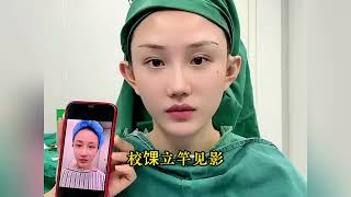 廖氏超V提面部年轻化六大优势