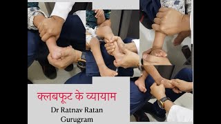 क्लबफूट के व्यायाम|Clubfoot exercises|क्लबफूट में कैसे बचें आपरेशन से|Dr Ratnav Ratan #CTEV#clubfoot