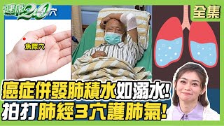 柯爸癌症肺積水病逝2症狀如溺水般難呼吸！拍打肺經3穴護肺氣！累喘腫3症狀恐心臟衰竭！紅色食物助養心！健康2.0 20250309【完整版】#鄭凱云 #李琳 #林謂文 #陳麗華 #吳明珠 #雷議宗