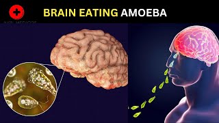 How Naegleria Fowleri Eats Human Brain?