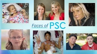 Faces of PSC