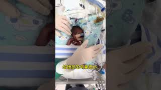 早产儿