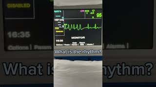 What is the rhythm? EP.1 #shorts #ekg  #ecg #frontlineekg