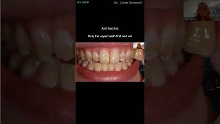 Heads Up: Are Your Child's Teeth IMPERFECT? The REAL Goal of Whitening!