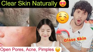 Get Clear Skin Naturally | Remove Pimples, Dark Spots & Open Pores, Men Grooming tips, Men Skincare,