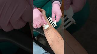 COME WITH ME: Allergy Testing #allergytesting #allergytest #comewithme
