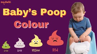 Baby’s Poop Colour!