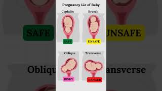 Presentation and Baby's Lie During Pregnancy 👶#shorts