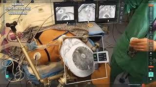 Medivis AR for anatomy